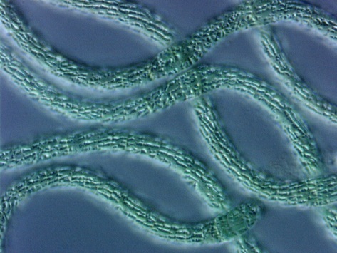 cyanobacteria